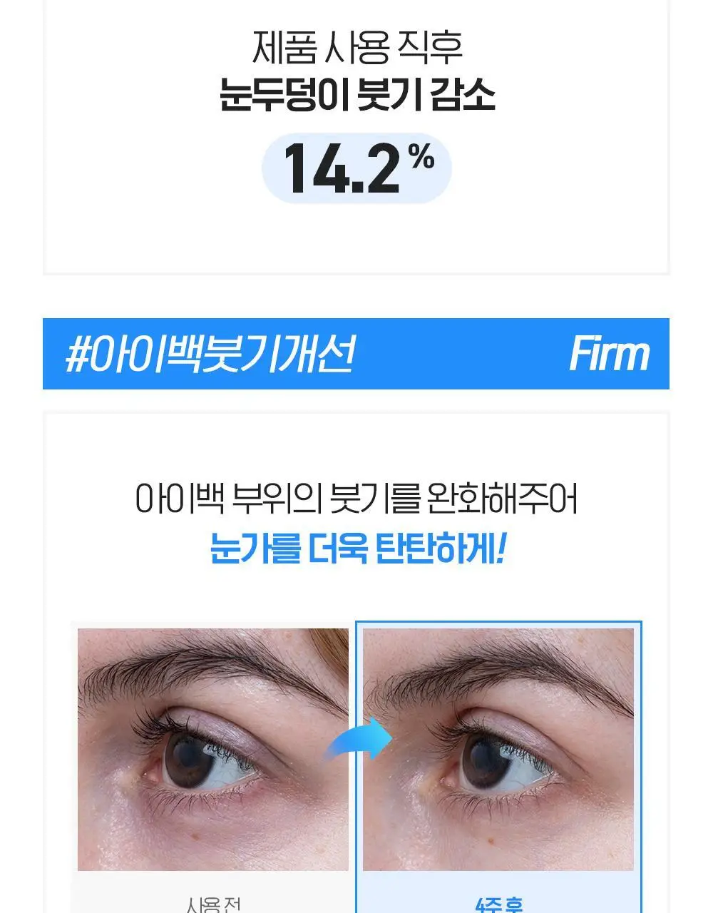 [눈가탄력UP] 빌리프 아쿠아 밤 아이젤 15ml 상세페이지 11